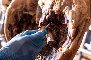 スピラトゥーラ